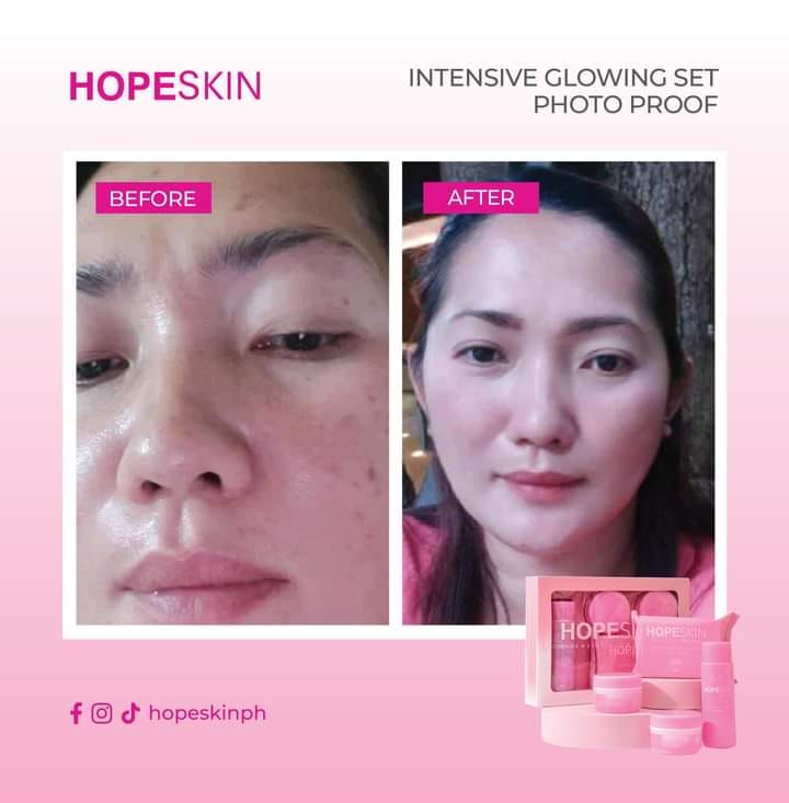 HOPE SKIN Glowing Set