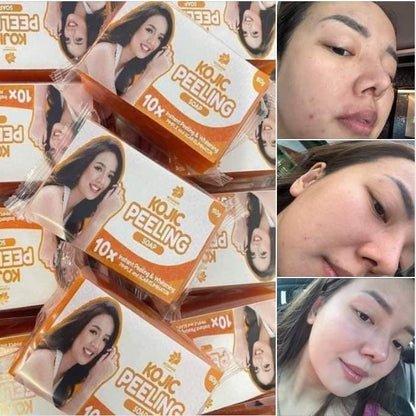 Rosmar Kojic Peeling Soap 150g