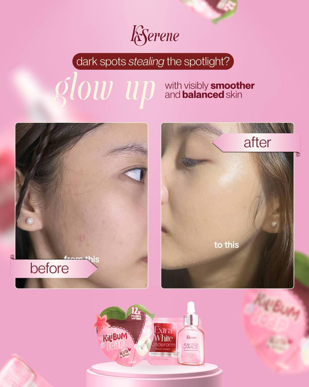 Combo of KSerene Extra White Underarm Serum & Kilibum Soap