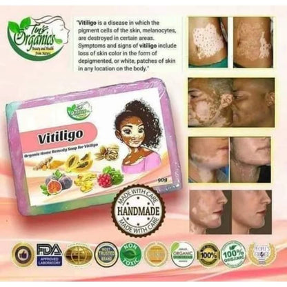 TINS ORGANIC Vitiligo Organic Home Remedy Soap