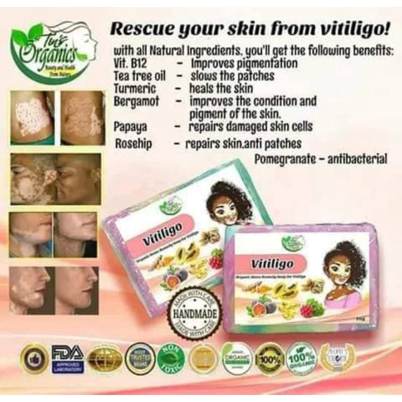 TINS ORGANIC Vitiligo Organic Home Remedy Soap