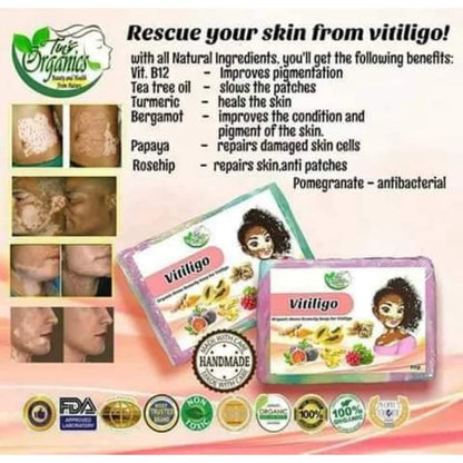 TINS ORGANIC Vitiligo Organic Home Remedy Soap