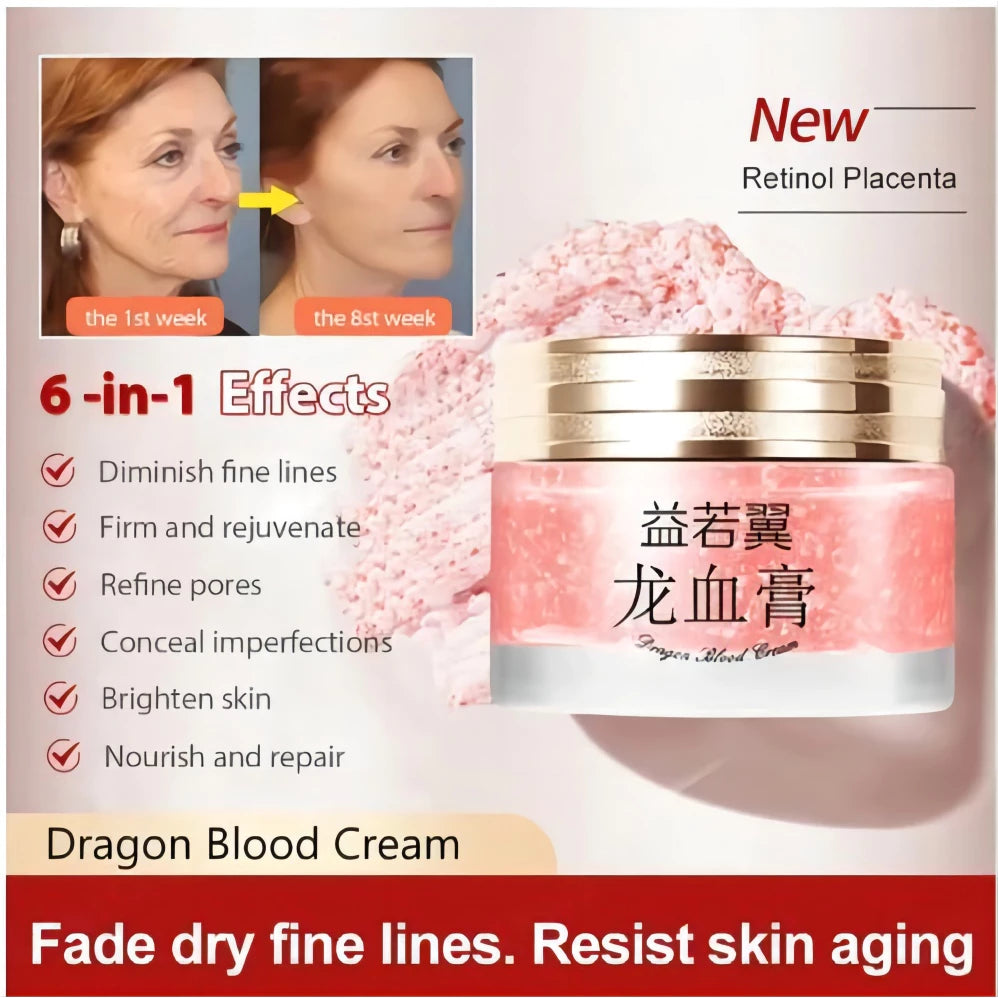 Dragon Blood Retinol Cream Melasma Remover 50g