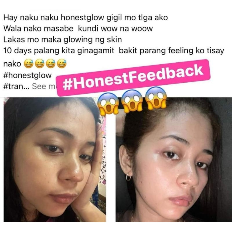 Honest Glow Facial Set Transformed Skin Set