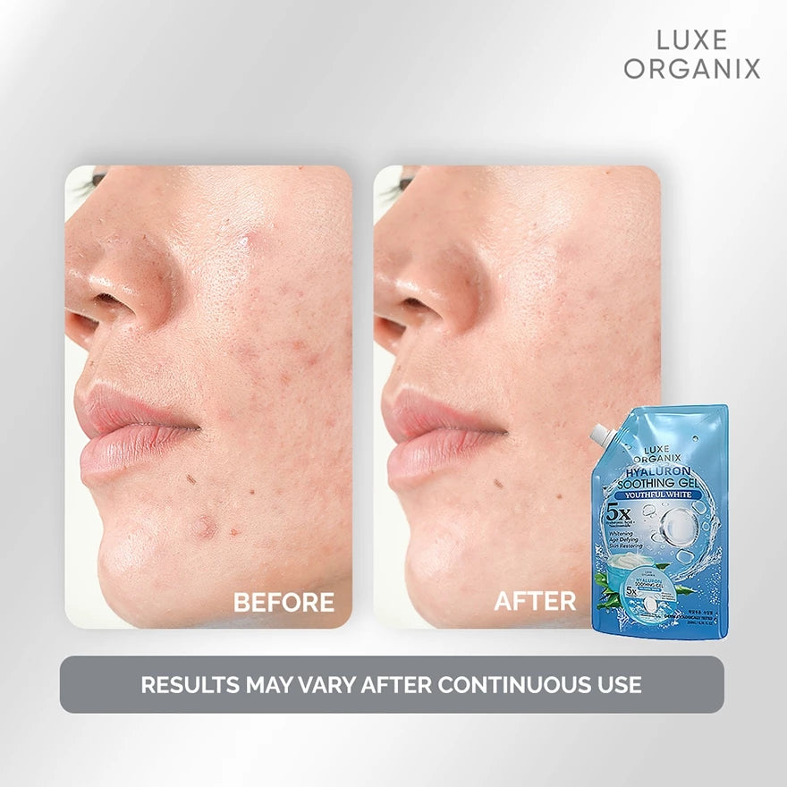 LUXE ORGANIX Hyaluron Soothing Gel 200ml