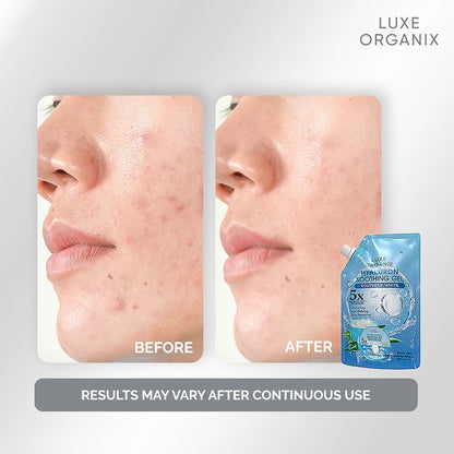 LUXE ORGANIX Hyaluron Soothing Gel 200ml