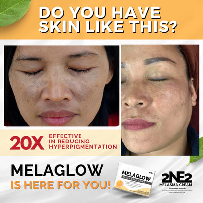 MelaGlow Melasma Soap with Tea Tree Oil for Dark Spots 100g