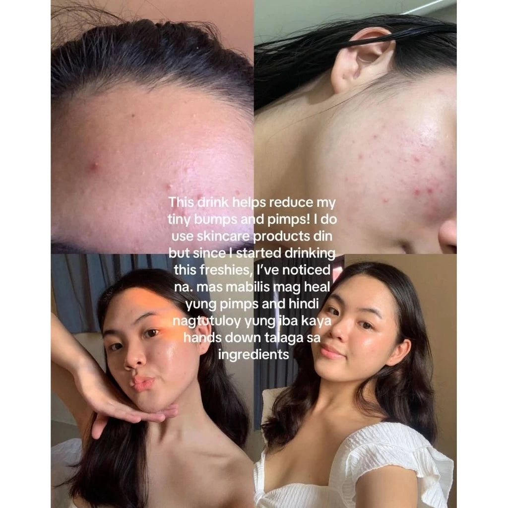 FRESHIES Avocado Collagen New Packaging