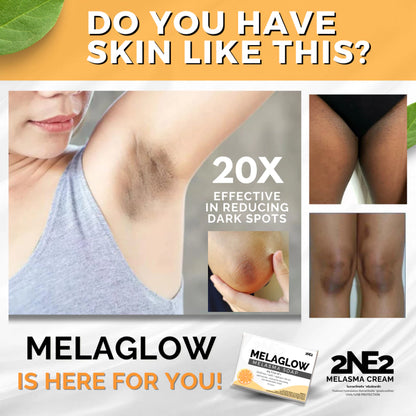 MelaGlow Melasma Soap with Tea Tree Oil for Dark Spots 100g