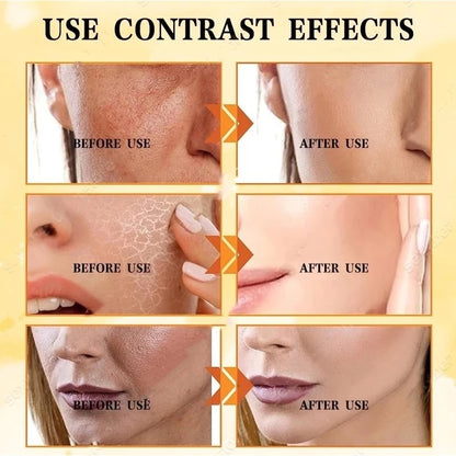 Combo Vitamin C Toner + Kiss beauty Sunscreen + Sadoer Serum