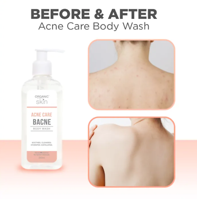 Organic Skin Japan Acne Care Bacne Body Wash 250ml