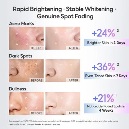 PAPA FEEL 577 Dark Spot Serum Hydrating Brightening Firming 30Ml